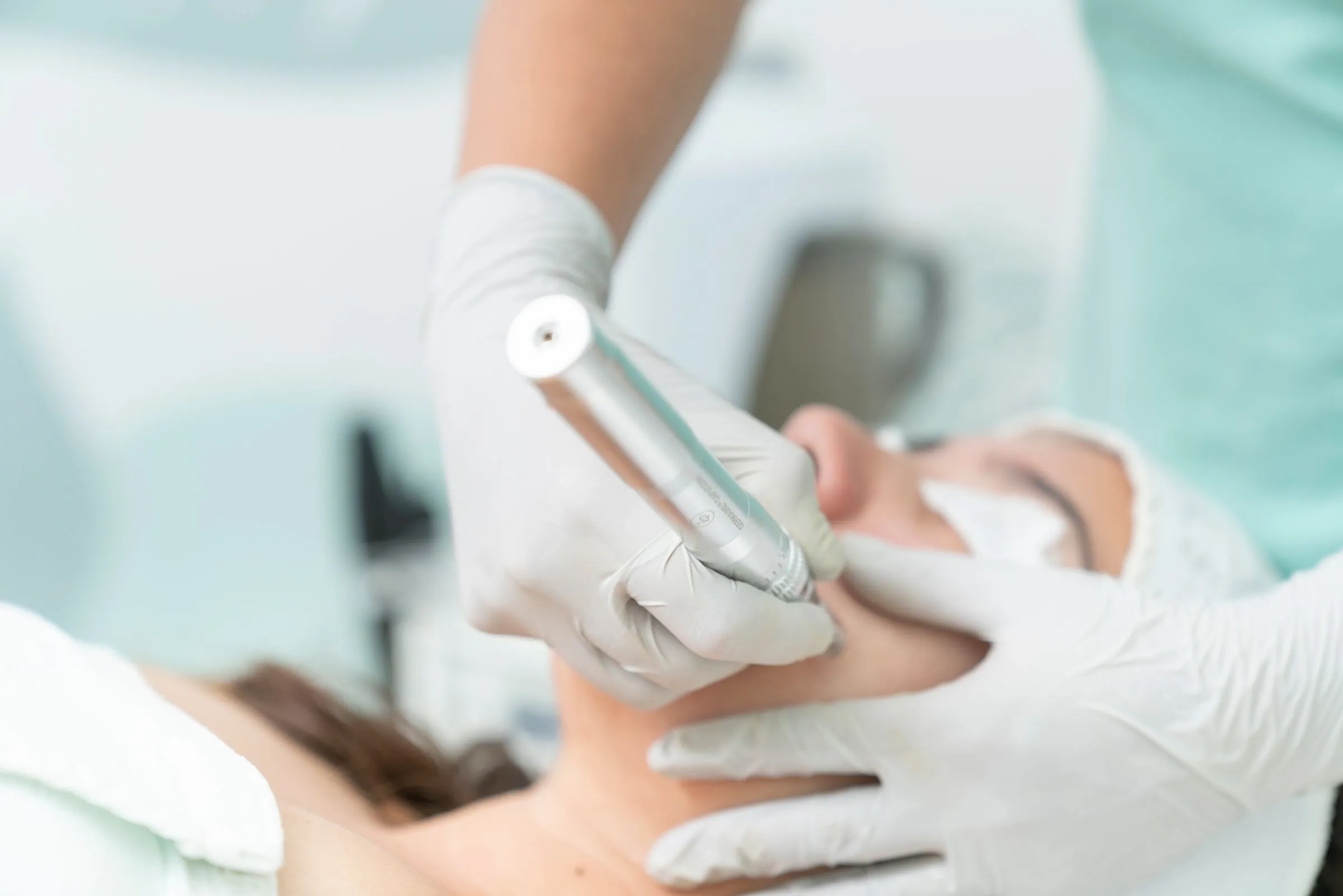 A close-up of a skin treatment device being used in a clinic
