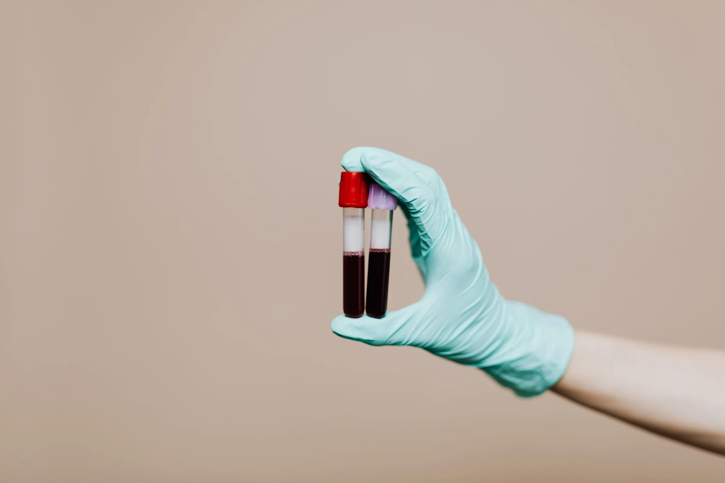A gloved hand holding two sealed blood sample tubes