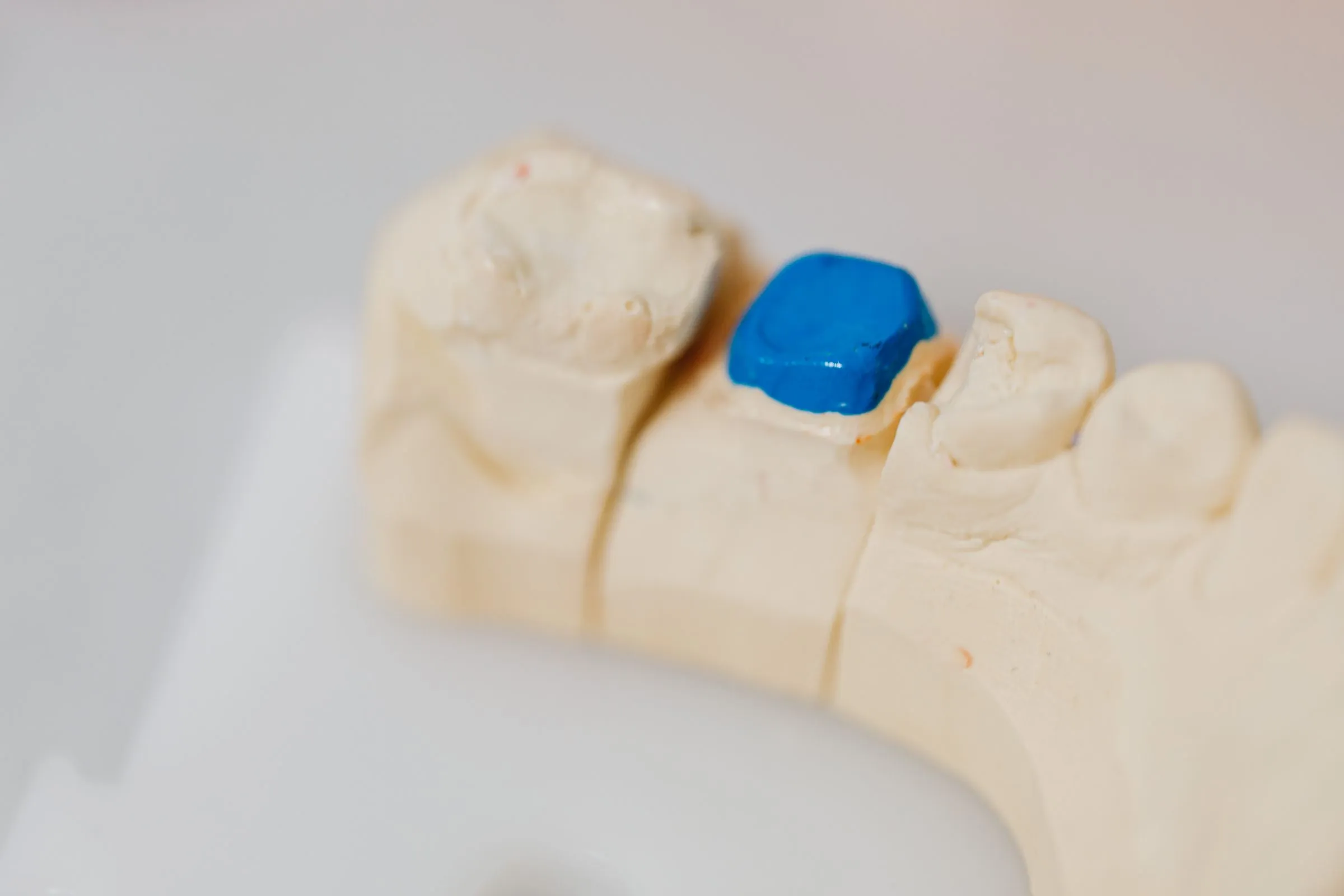 A dental crown being shaped on a plaster model in a laboratory