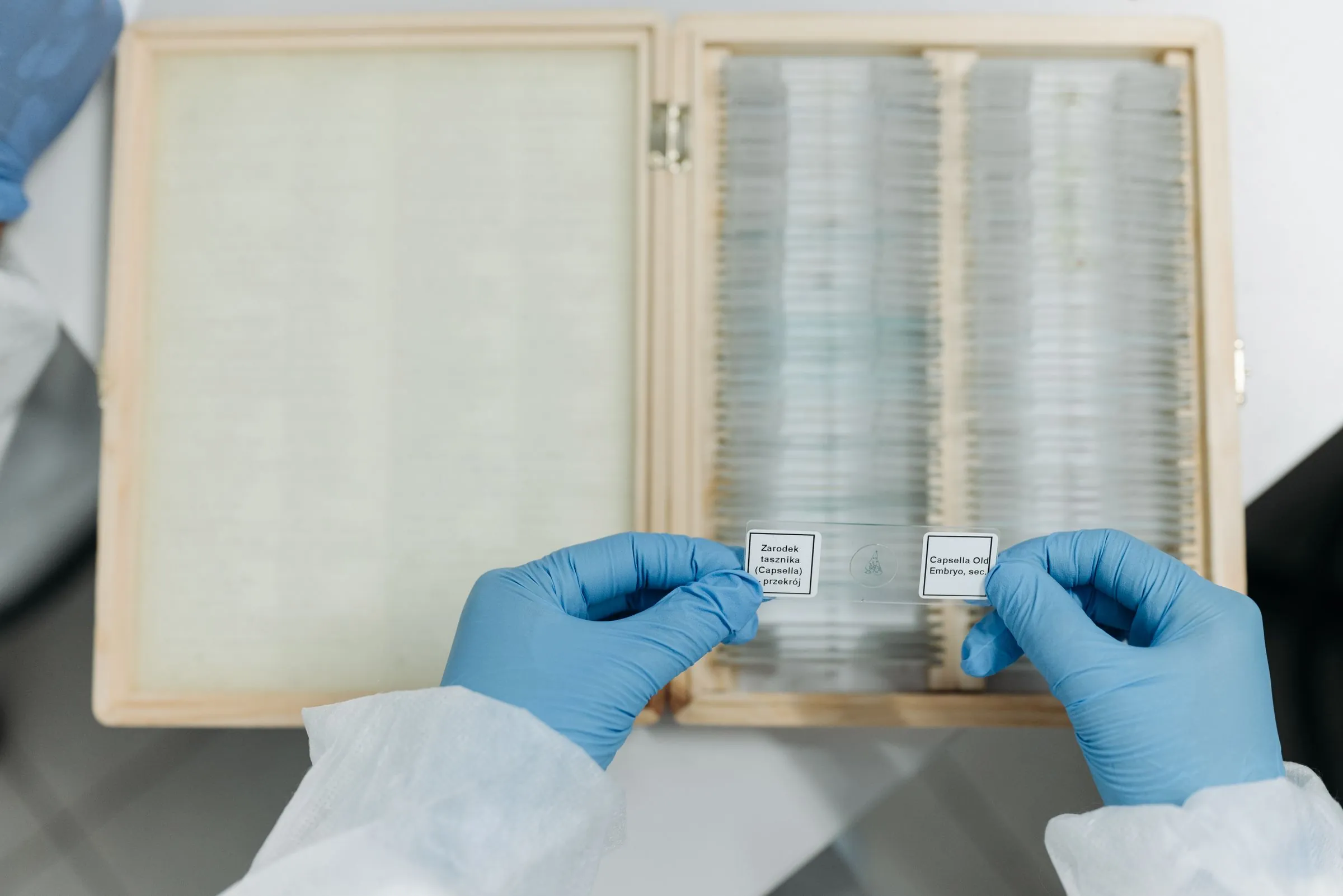 Gloved hands handling labelled microscope slides in a laboratory