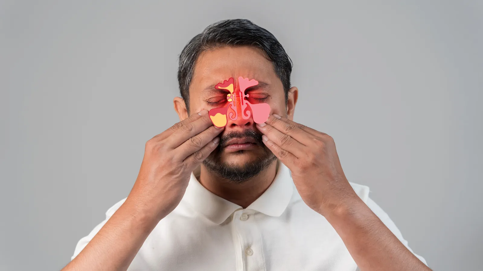 Sinus pressure and inflammation affecting the facial sinuses in an adult patient